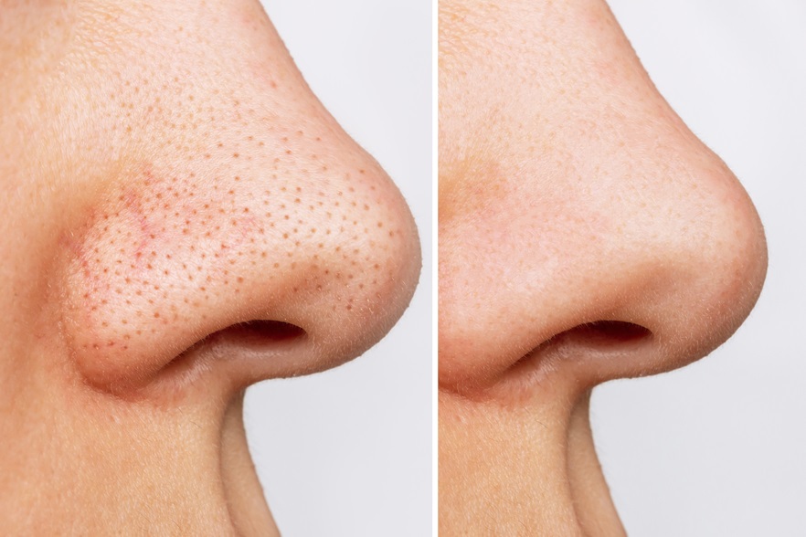 ANUA Heartleaf Pore Control Cleansing Oil - Image 2